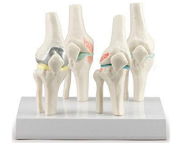 HL/A141 四阶段膝关节模型