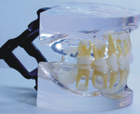 HL/Y10012-2 透明乳牙发育模型（5-9岁）
