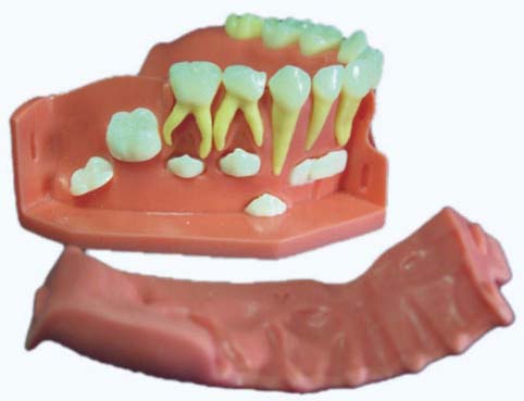 HL/Y10077-2 牙列发育模型